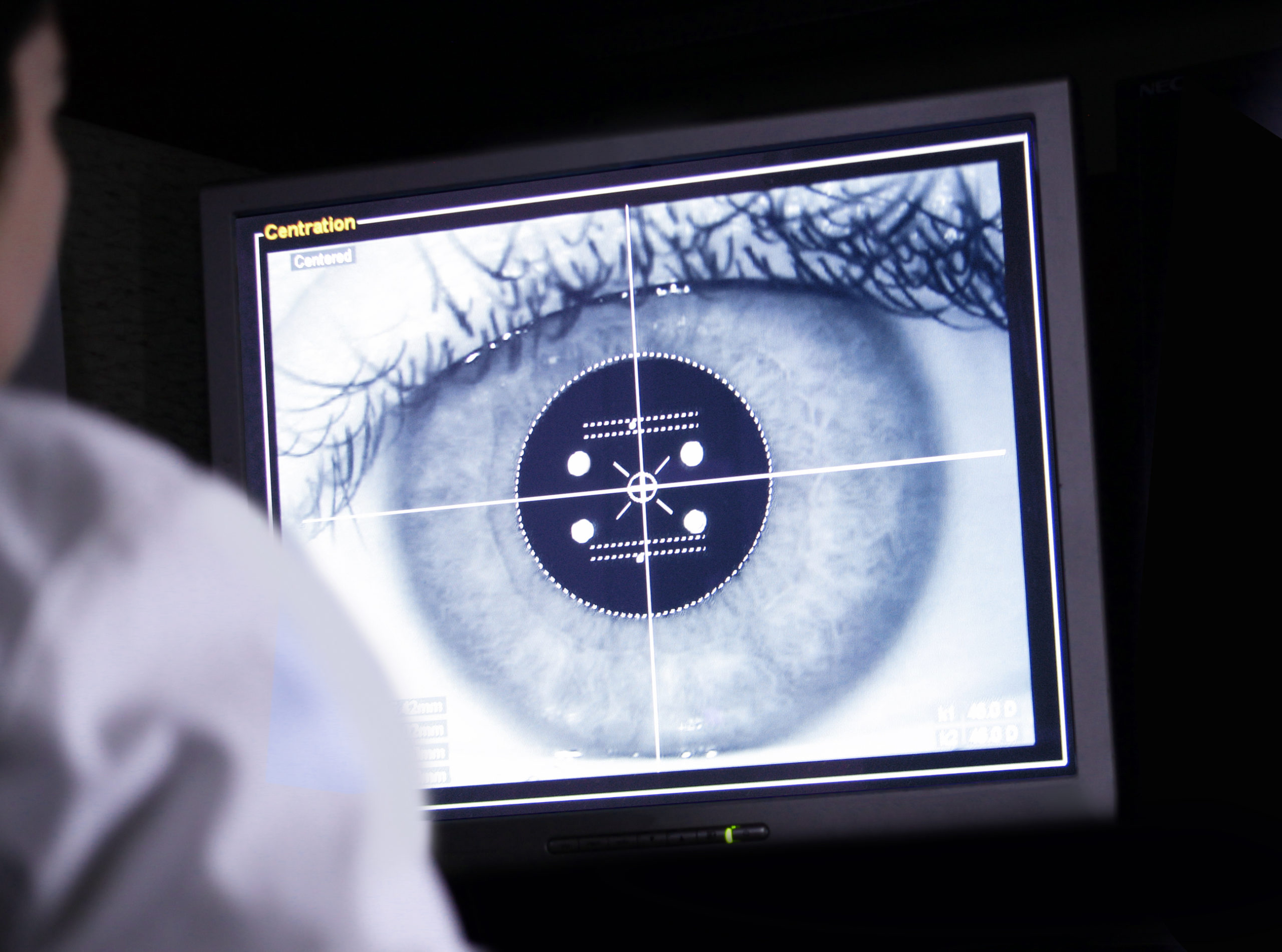 computer eye scan