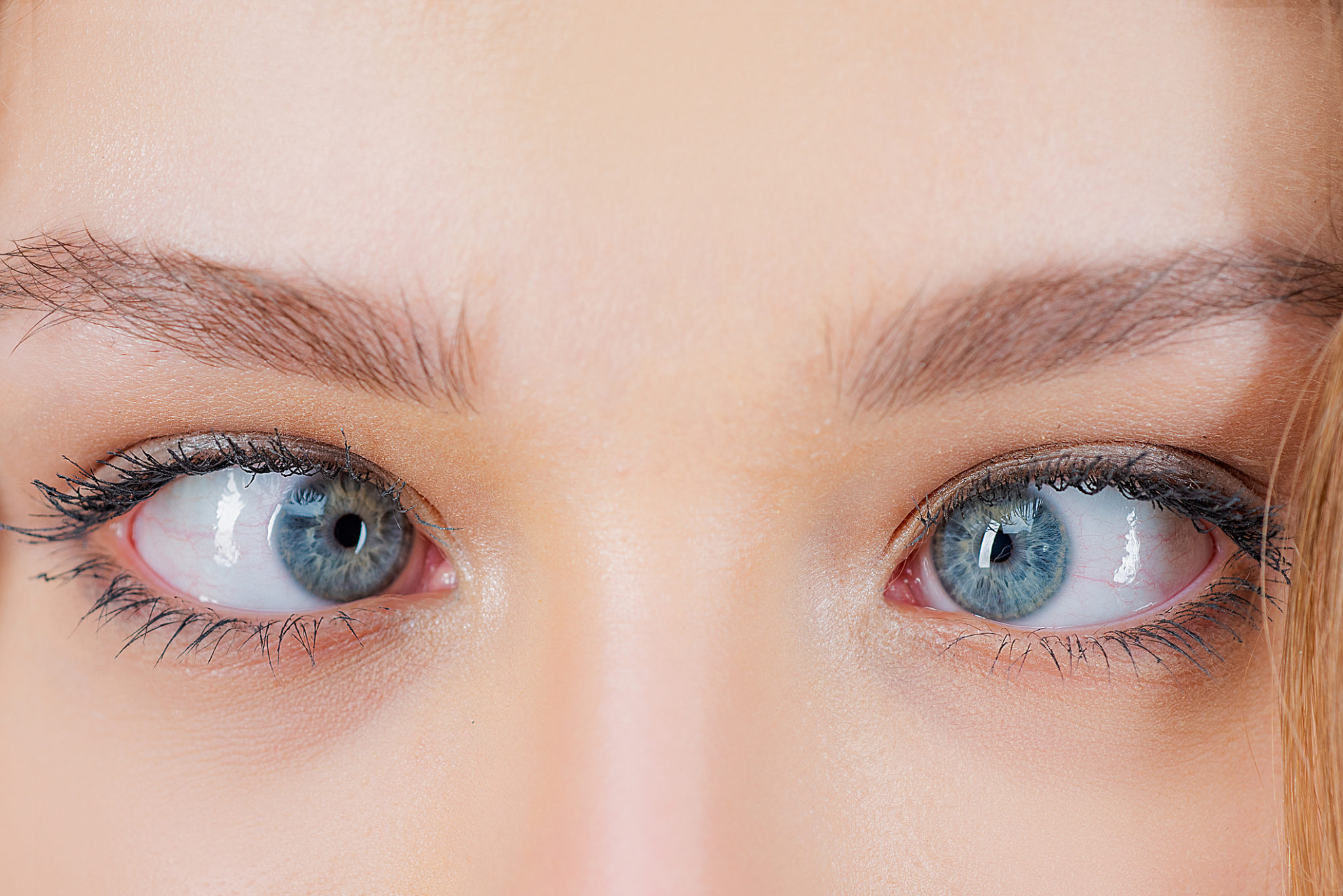 Strabismus Symptoms & Causes | ICON Eyecare | Denver, CO