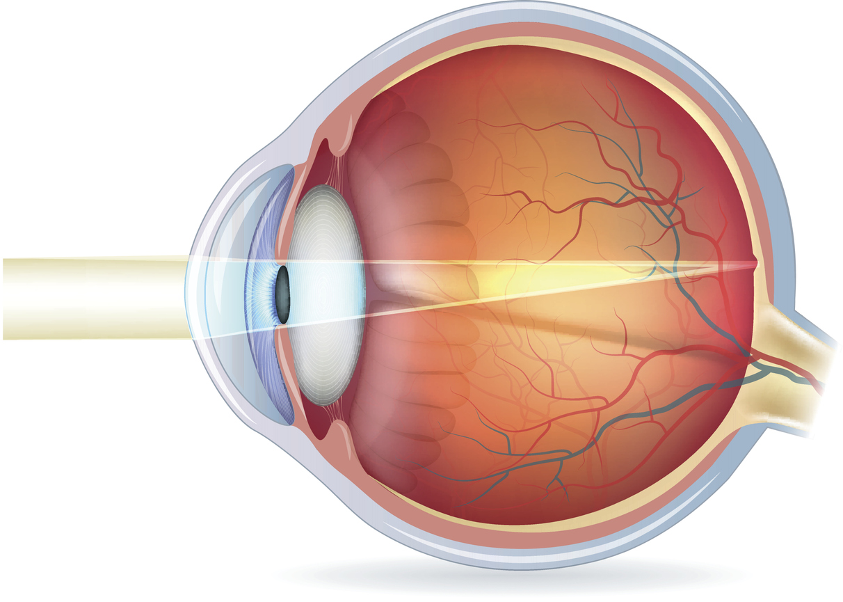 How Does Vision Actually Work? - LASIK Denver